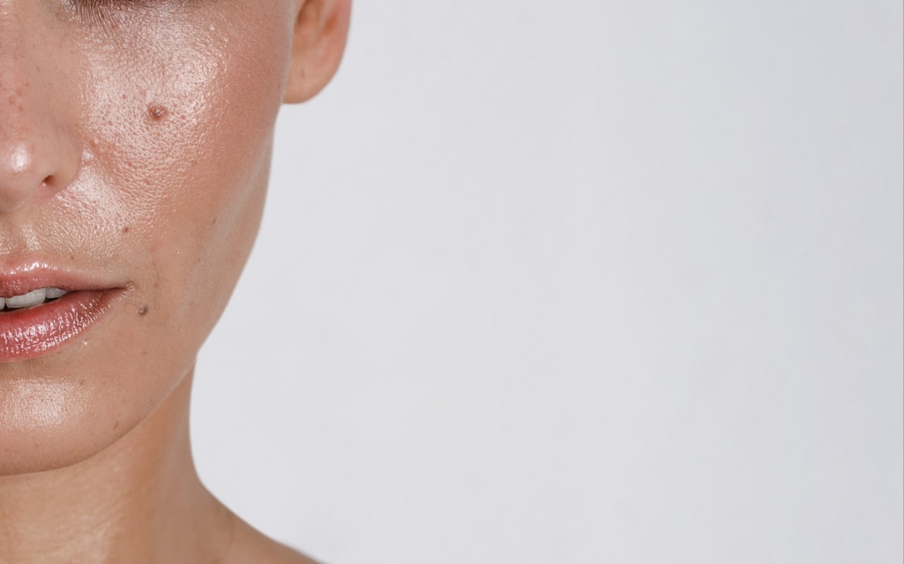 Gli attivi approvati dalla scienza in caso di pelle grassa. La parola della dermatologa Ines Mordente