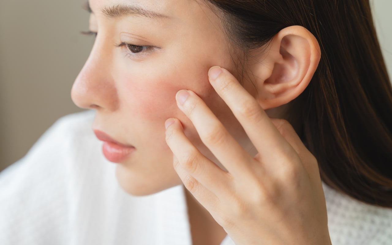 Allergia al viso: cos'è?