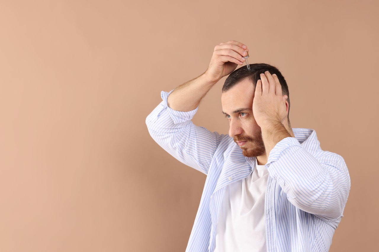 J’ai le cuir chevelu gras : causes et astuces naturelles