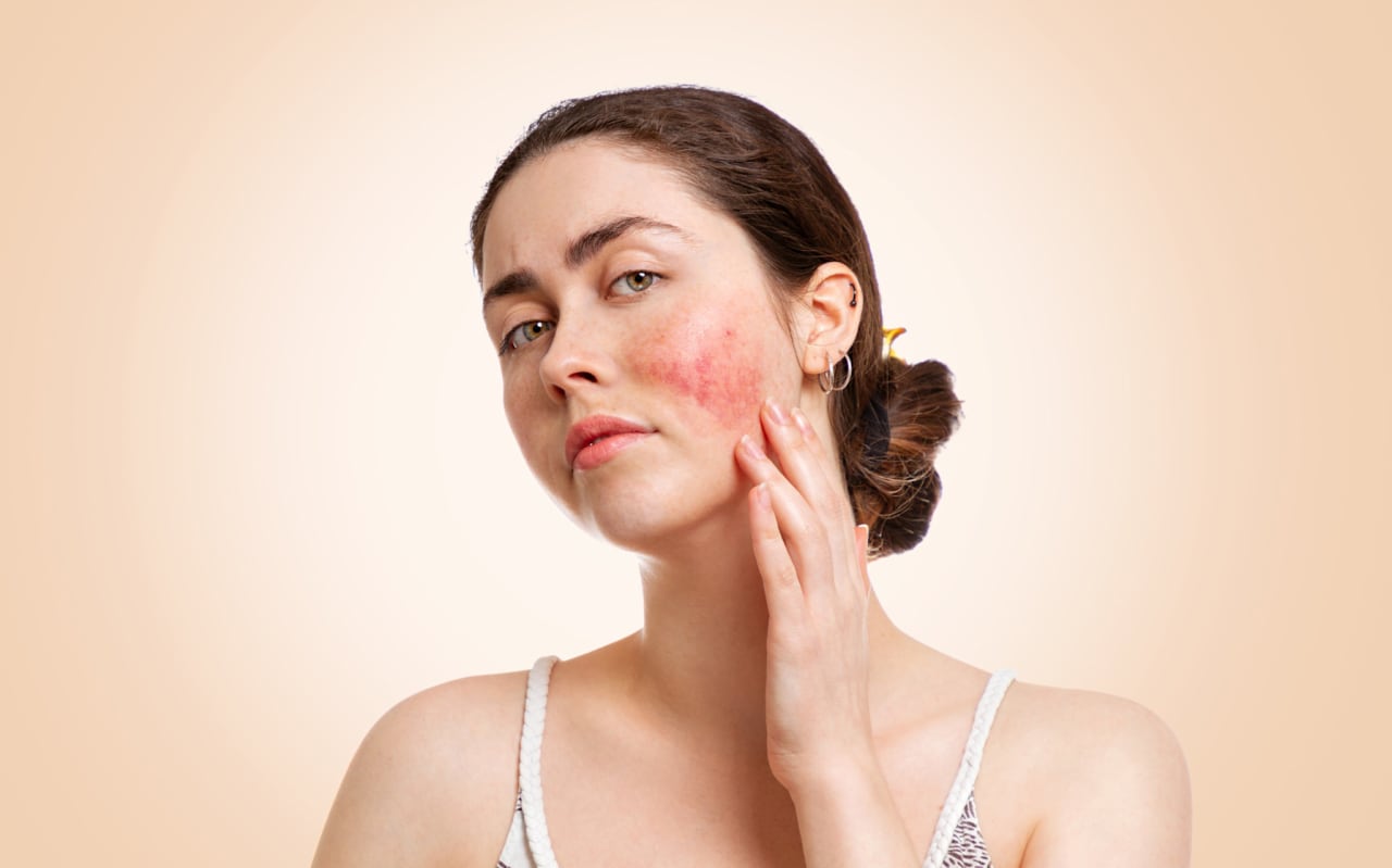 Inflammation cutanée : causes et symptômes