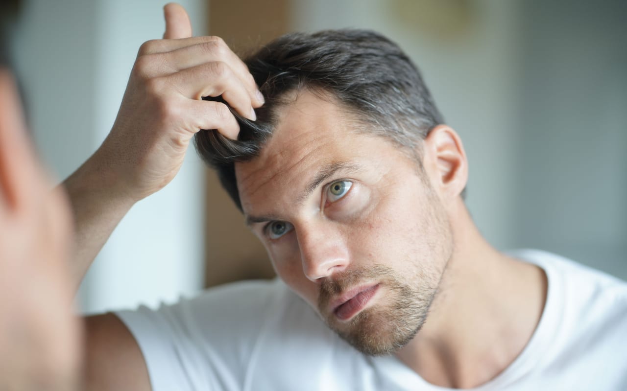 Nos astuces naturelles pour lutter contre la calvitie