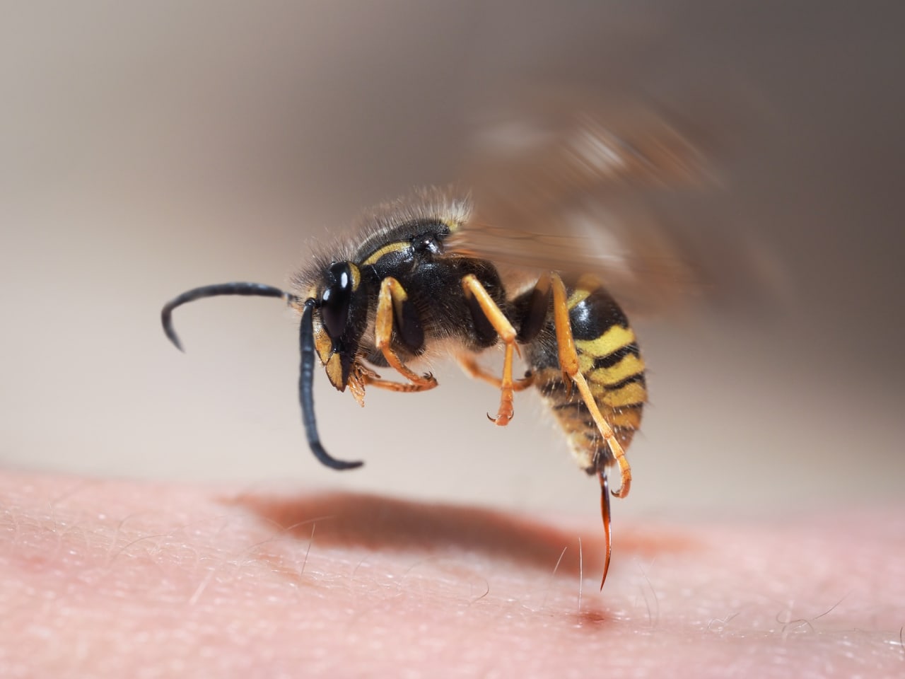 Riconoscere e identificare le punture di insetti comuni