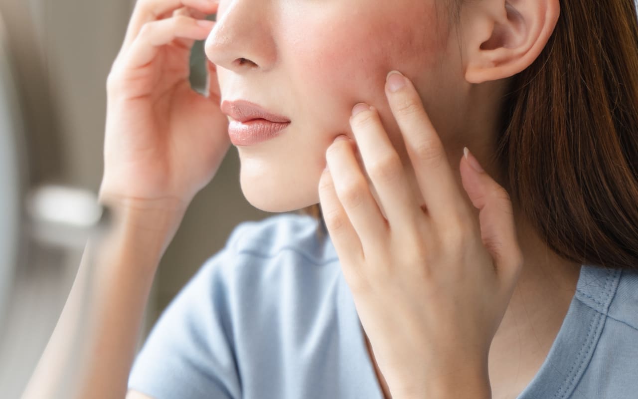 Allergies saisonnières : leur impact sur la peau (on en parle peu)