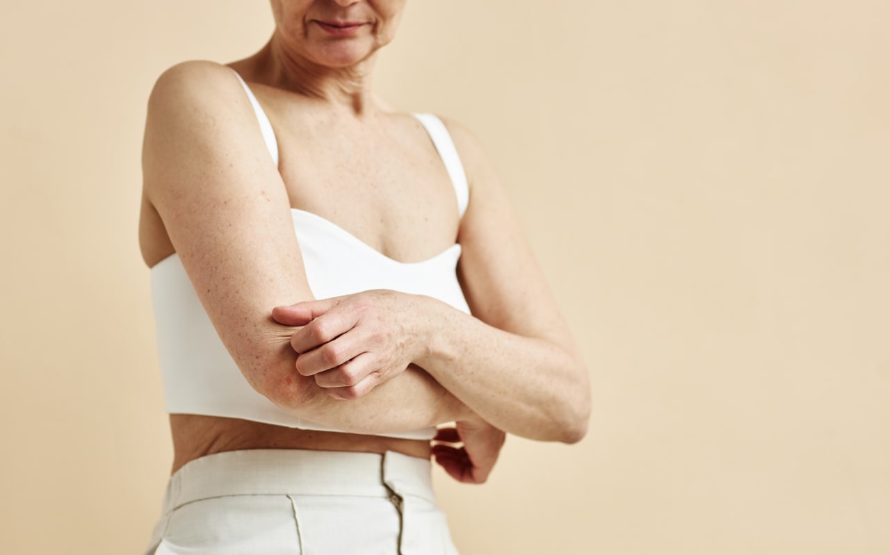 Quels compléments alimentaires et probiotiques pour atténuer l'eczéma et le psoriasis ?
