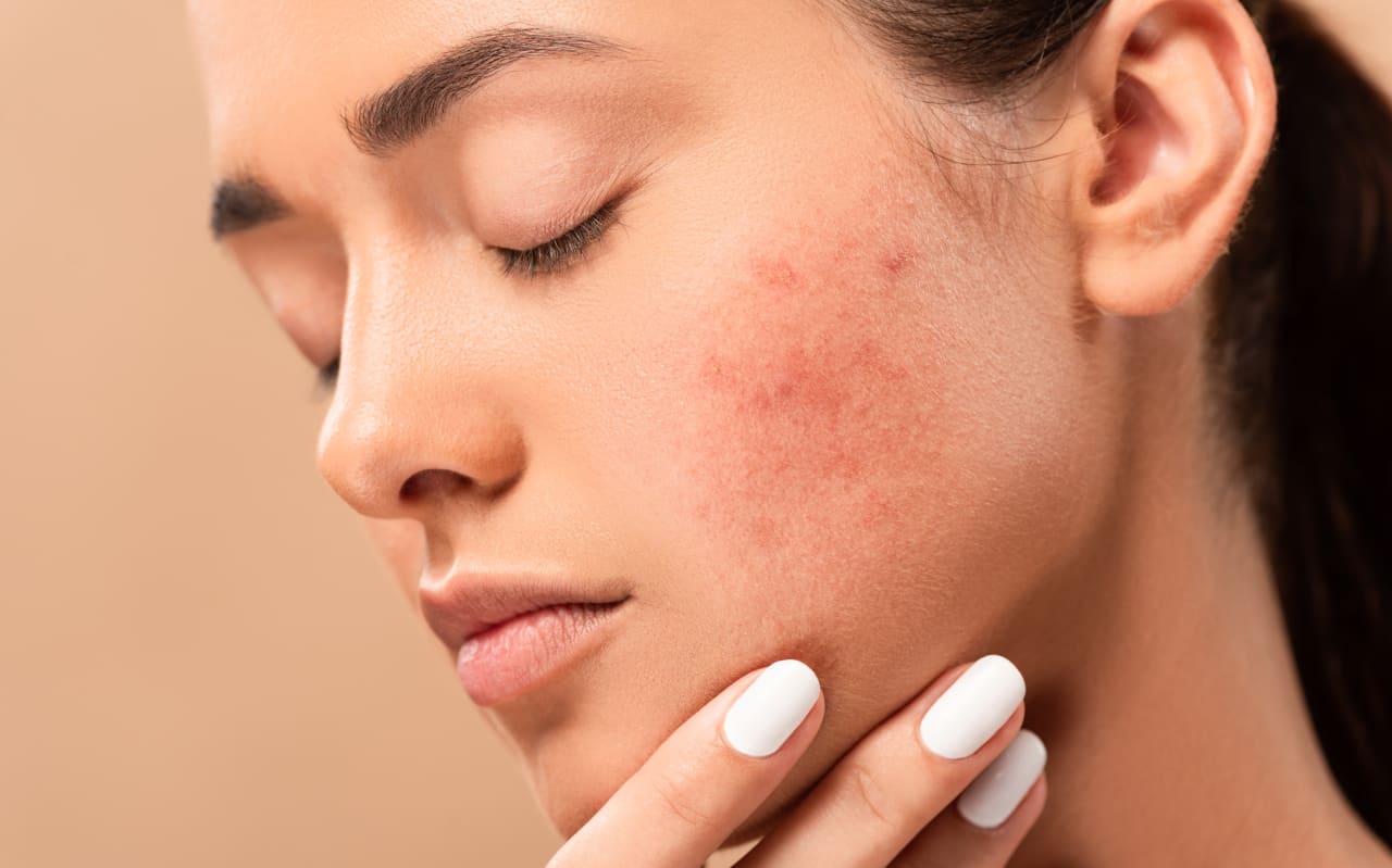 Nodule sous la peau : qu'est ce que c'est ?