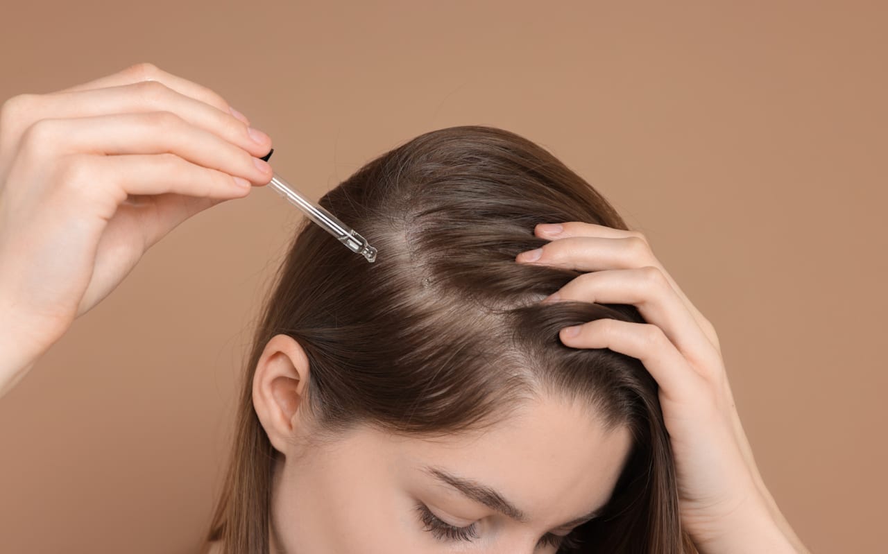 Pelade : Causes et symptômes
