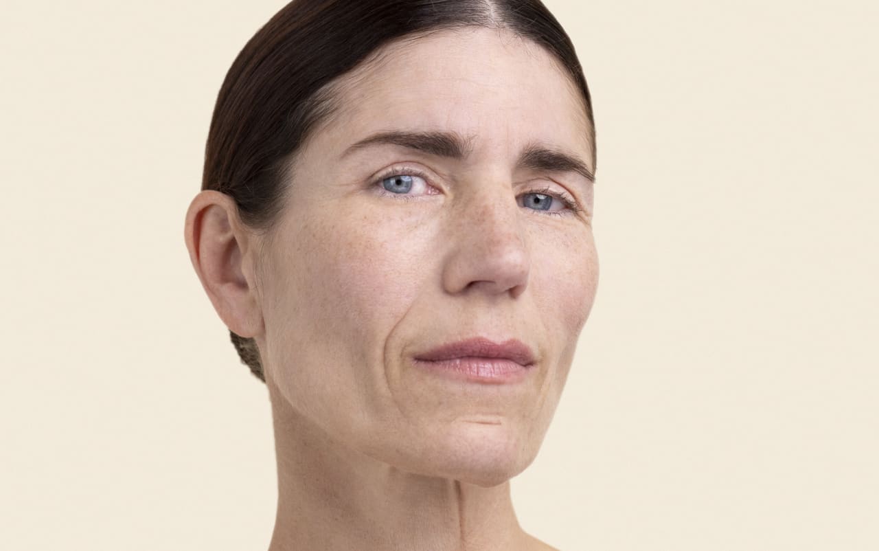 Pourquoi ma peau reste-t-elle sèche malgré l’application d’une crème hydratante ?