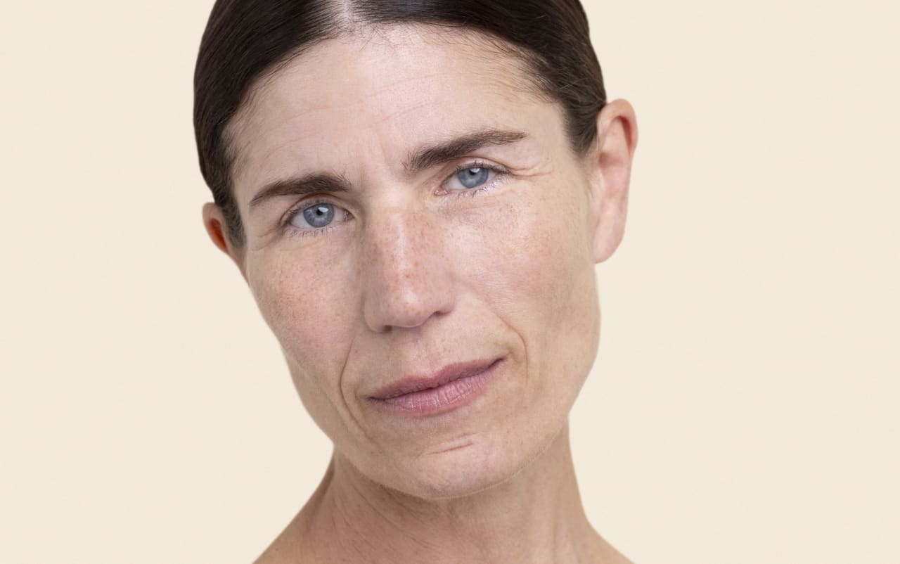 Raffermissement du cou : quelles solutions naturelles ?