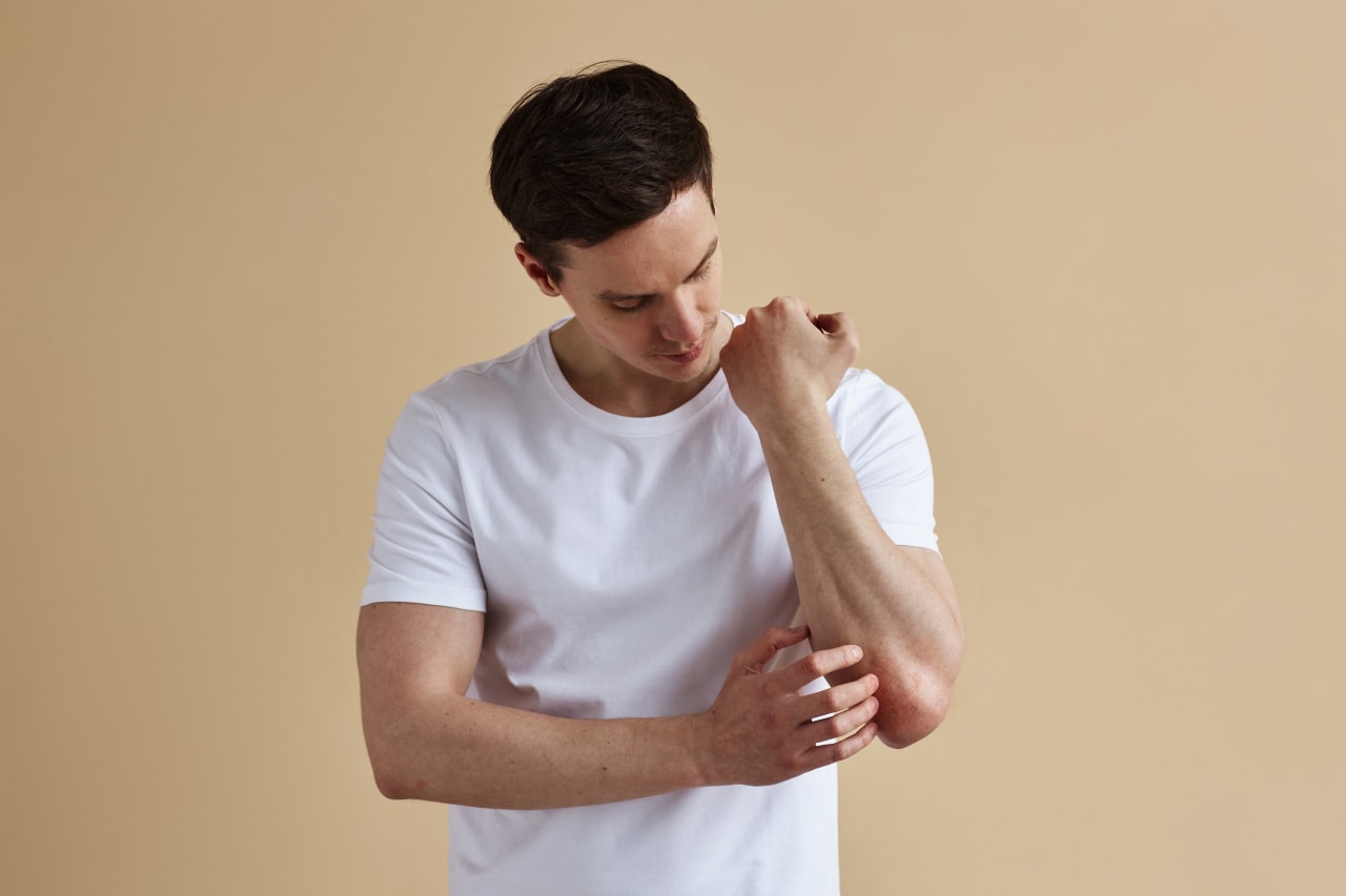 Eczéma nummulaire : tout savoir sur ses spécificités