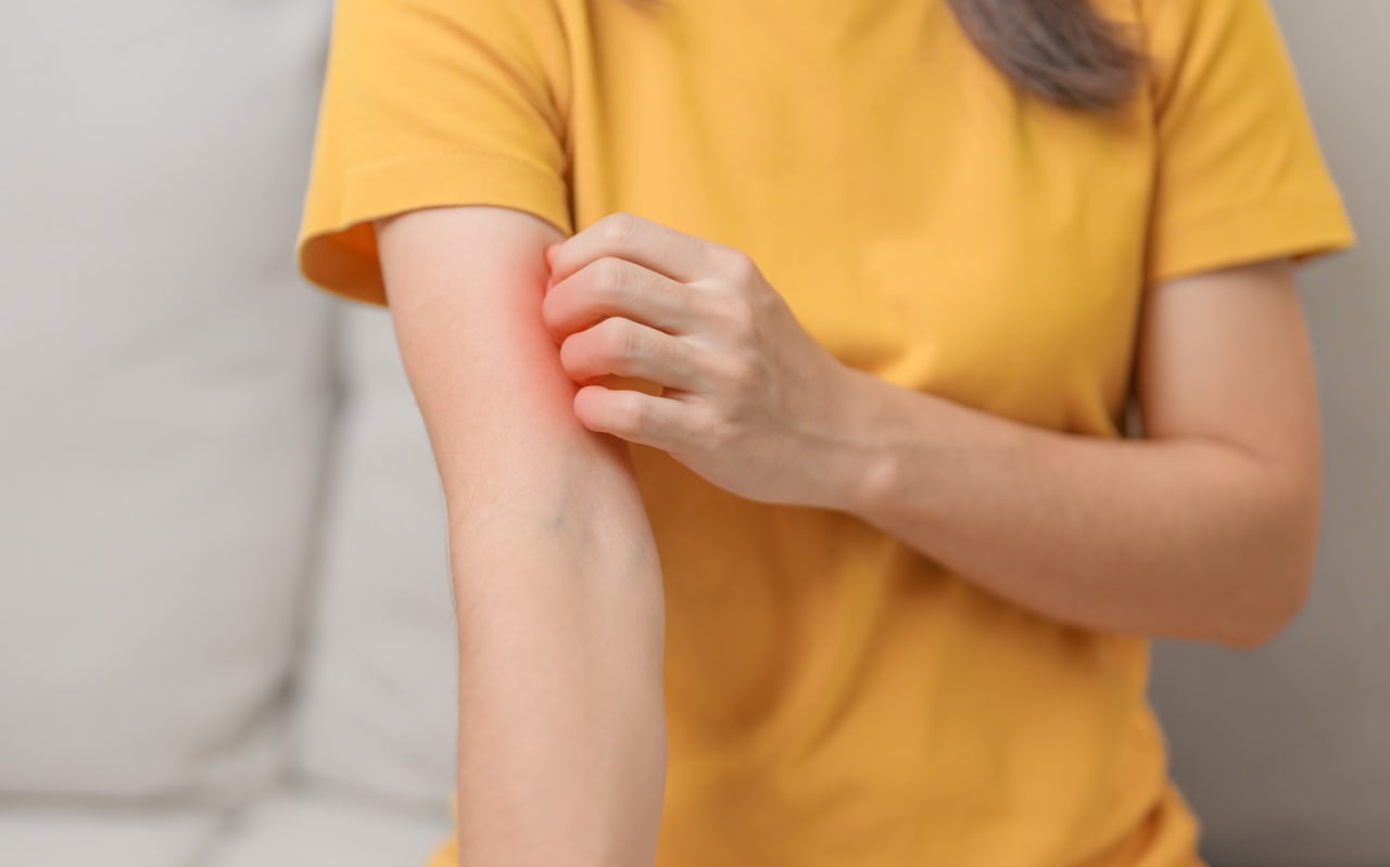 Piqûre de chenille : que faire ?