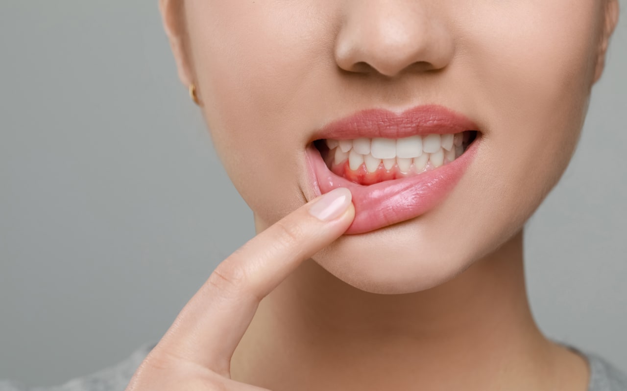 Redécouvrir un rituel ancestral : l’oil pulling pour votre santé bucco-dentaire
