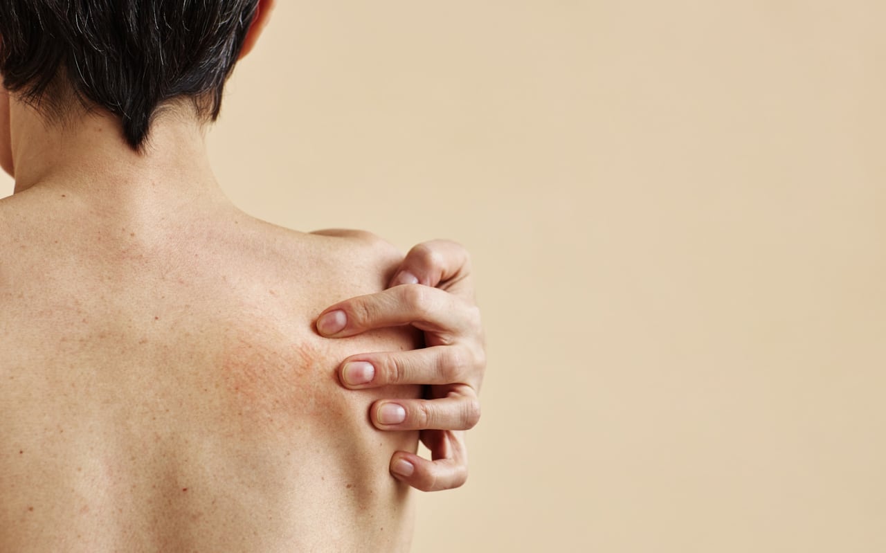 Prurit cutané : Causes et symptômes