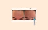 100% Hyaluronic Acid Pearl Serum
